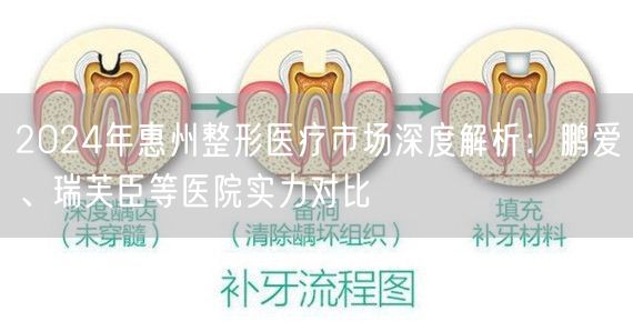 2024年惠州整形医疗市场深度解析：鹏爱、瑞芙臣等医院实力对比