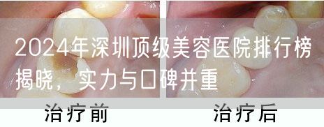 2024年深圳顶级美容医院排行榜揭晓，实力与口碑并重