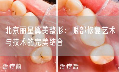 北京丽星翼美整形：眼部修复艺术与技术的完美结合