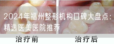 2024年福州整形机构口碑大盘点：精选医美医院推荐