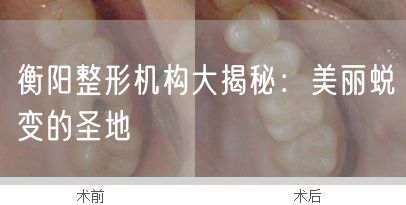 衡阳整形机构大揭秘：美丽蜕变的圣地