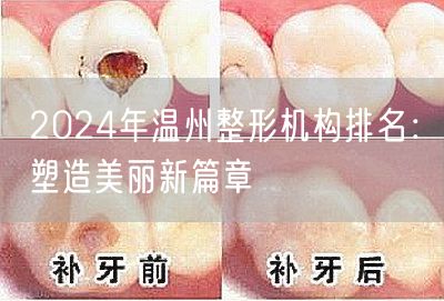 2024年温州整形机构排名：塑造美丽新篇章