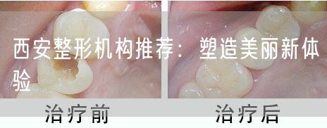 西安整形机构推荐：塑造美丽新体验