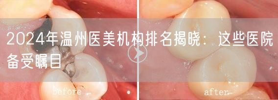 2024年温州医美机构排名揭晓：这些医院备受瞩目