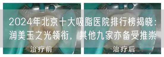 2024年北京十大吸脂医院排行榜揭晓：润美玉之光领衔，其他九家亦备受推崇