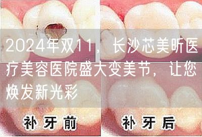 2024年双11，长沙芯美昕医疗美容医院盛大变美节，让您焕发新光彩