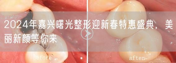 2024年嘉兴曙光整形迎新春特惠盛典，美丽新颜等你来