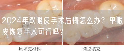 2024年双眼皮手术后悔怎么办？单眼皮恢复手术可行吗？