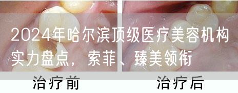 2024年哈尔滨顶级医疗美容机构实力盘点，索菲、臻美领衔