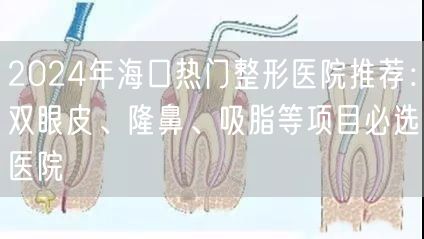 2024年海口热门整形医院推荐：双眼皮、隆鼻、吸脂等项目必选医院