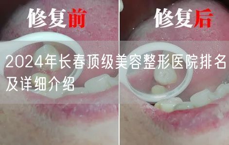 2024年长春顶级美容整形医院排名及详细介绍