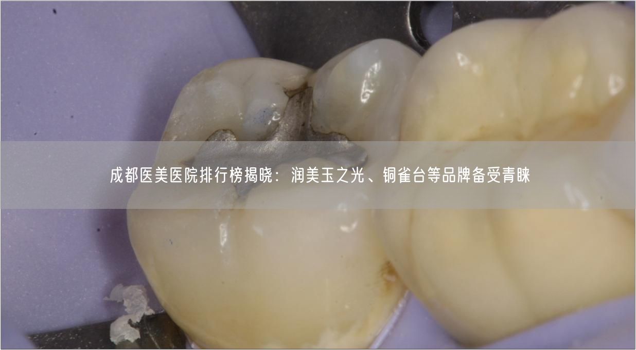 成都医美医院排行榜揭晓：润美玉之光、铜雀台等品牌备受青睐