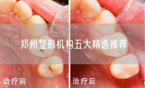 郑州整形机构五大精选推荐