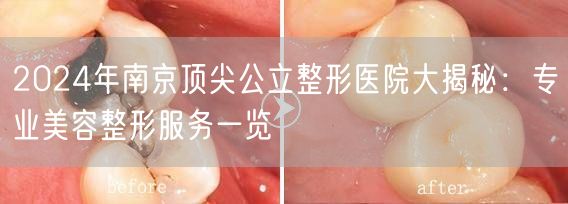 2024年南京顶尖公立整形医院大揭秘：专业美容整形服务一览