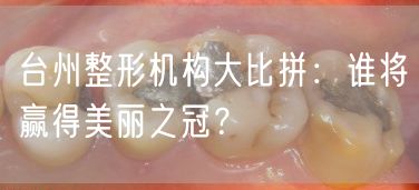 台州整形机构大比拼：谁将赢得美丽之冠？