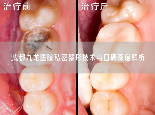 成都九龙医院私密整形技术与口碑深度解析