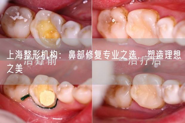 上海整形机构：鼻部修复专业之选，塑造理想之美