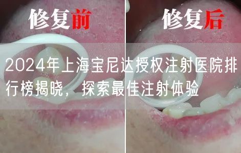 2024年上海宝尼达授权注射医院排行榜揭晓，探索最佳注射体验