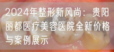 2024年整形新风尚：贵阳丽都医疗美容医院全新价格与案例展示