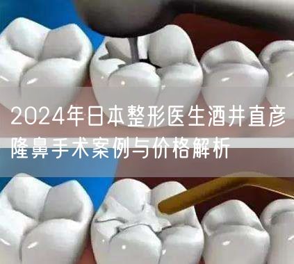 2024年日本整形医生酒井直彦隆鼻手术案例与价格解析