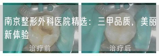 南京整形外科医院精选：三甲品质，美丽新体验