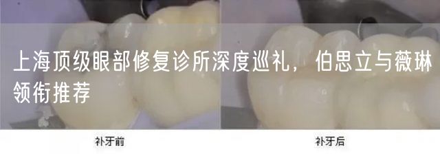 上海顶级眼部修复诊所深度巡礼，伯思立与薇琳领衔推荐