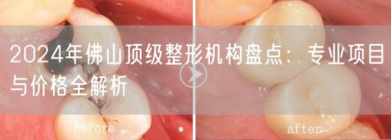2024年佛山顶级整形机构盘点：专业项目与价格全解析
