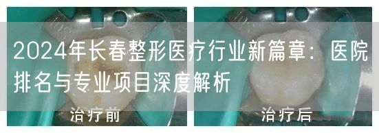 2024年长春整形医疗行业新篇章：医院排名与专业项目深度解析
