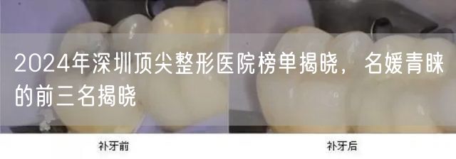 2024年深圳顶尖整形医院榜单揭晓，名媛青睐的前三名揭晓