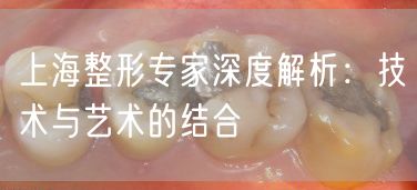 上海整形专家深度解析：技术与艺术的结合