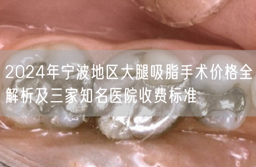 2024年宁波地区大腿吸脂手术价格全解析及三家知名医院收费标准