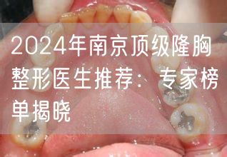 2024年南京顶级隆胸整形医生推荐：专家榜单揭晓