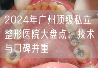 2024年广州顶级私立整形医院大盘点：技术与口碑并重