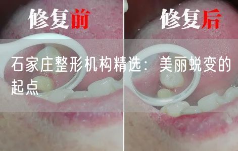 石家庄整形机构精选：美丽蜕变的起点