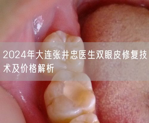 2024年大连张井忠医生双眼皮修复技术及价格解析
