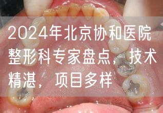 2024年北京协和医院整形科专家盘点，技术精湛，项目多样