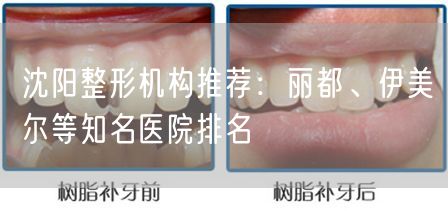 沈阳整形机构推荐：丽都、伊美尔等知名医院排名