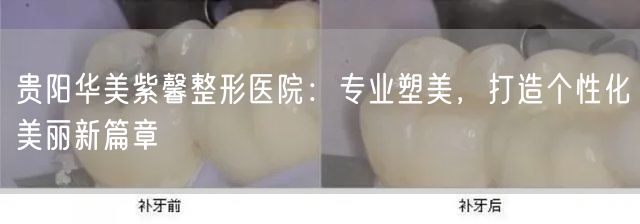 贵阳华美紫馨整形医院：专业塑美，打造个性化美丽新篇章