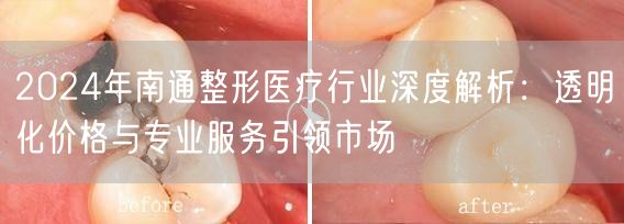 2024年南通整形医疗行业深度解析：透明化价格与专业服务引领市场