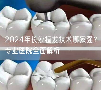 2024年长沙植发技术哪家强？专业医院全面解析