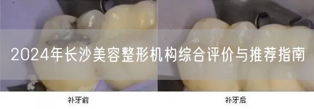 2024年长沙美容整形机构综合评价与推荐指南