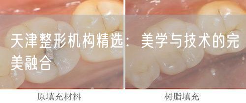天津整形机构精选：美学与技术的完美融合