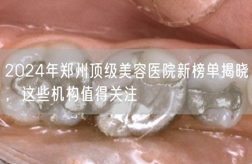2024年郑州顶级美容医院新榜单揭晓，这些机构值得关注