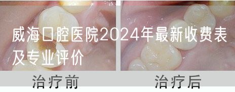 威海口腔医院2024年最新收费表及专业评价