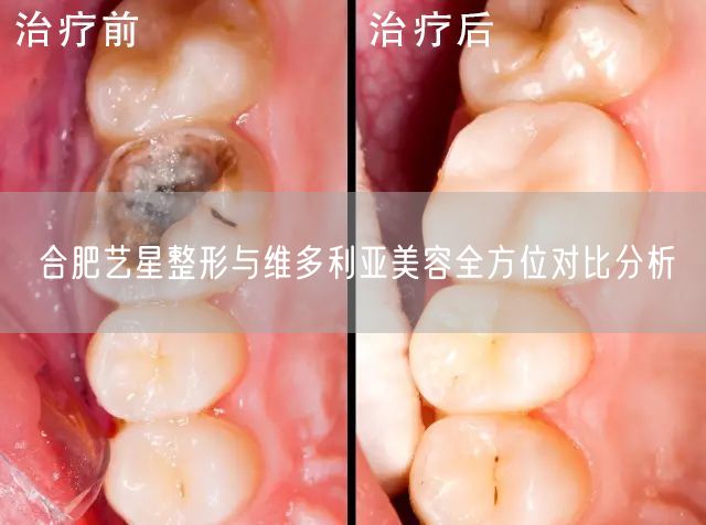 合肥艺星整形与维多利亚美容全方位对比分析