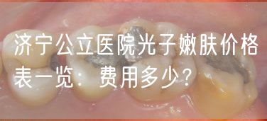 济宁公立医院光子嫩肤价格表一览：费用多少？