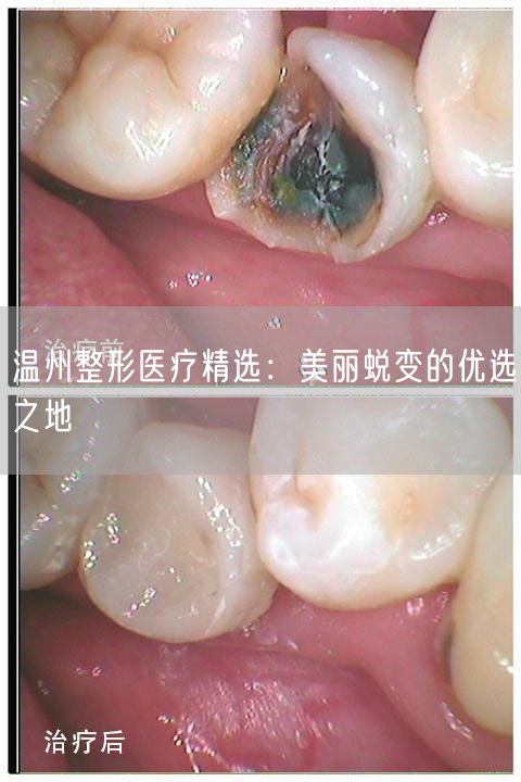 温州整形医疗精选：美丽蜕变的优选之地