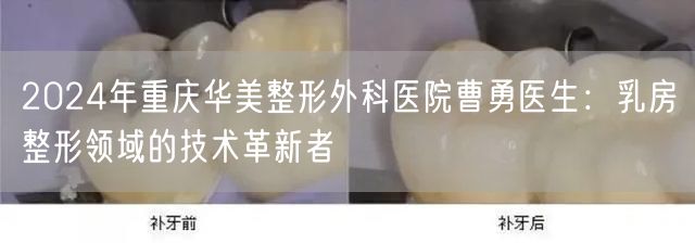 2024年重庆华美整形外科医院曹勇医生：乳房整形领域的技术革新者