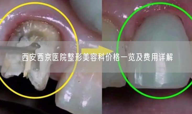西安西京医院整形美容科价格一览及费用详解