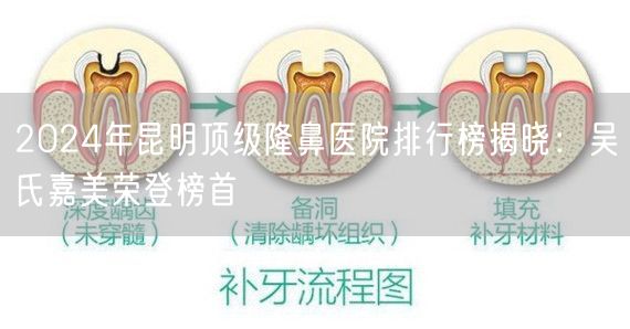 2024年昆明顶级隆鼻医院排行榜揭晓：吴氏嘉美荣登榜首